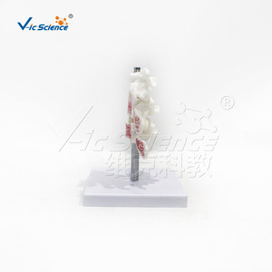 Modèle anatomique de colonne lombaire malade, modèle d'ostéoporose VIC-L034, ostéoporose de fémur humain. - Product Image 4