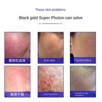 Appareil de soin du visage en alliage chromé noir et or, étanche, à lumière douce, pour unifier le teint, nettoyer le visage, atténuer les marques d'acné et éclaircir la peau, Ultra-Photon