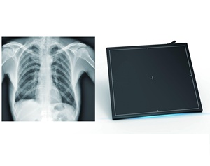 Mejor tener un detector de rayos X de panel plano con sistema de radiografía <span class=keywords><strong>digital</strong></span> con cable, detector de rayos X de panel plano - Product Image 4