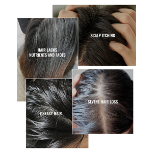 3 tipi di <span class=keywords><strong>Shampoo</strong></span> con olio di Tea Tree per capelli Anti-caduta <span class=keywords><strong>e</strong></span> Anti-forfora <span class=keywords><strong>e</strong></span> Anti-forfora <span class=keywords><strong>e</strong></span> olio per il controllo dello <span class=keywords><strong>Shampoo</strong></span> MOOYAM nutriente <span class=keywords><strong>e</strong></span> liscio - Product Image 3