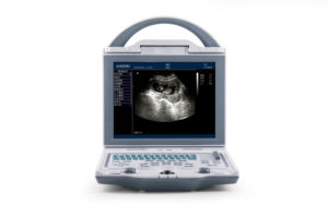 Kaixin KX5600V - Dispositivo de Monitoreo Veterinario Portátil de Alto Rendimiento, Escáner de Ultrasonido Médico Tipo Laptop - Product Image 4
