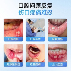 Haier's Hainuo Oral Ulcer Film for Mouth Blisters and Sores, <b>12</b> pieces/box, A382 - Product Image 4