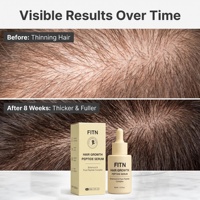 Minyak Penumbuh Rambut Alami Perawatan Kulit Kepala Bernutrisi Unisex Vegan Tanpa Prostaglandin Bersertifikat GMPC Logo Kustom Label Pribadi Grosir