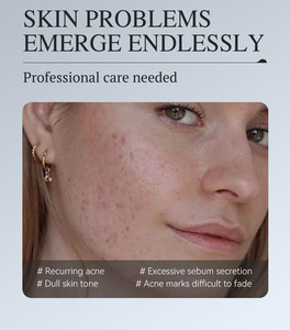Crema Hidratante Renovadora de Piel con <span class=keywords><strong>Retinol</strong></span>, Ilumina la Piel, Atenúa las Marcas del Acné, Controla la Grasa, Apta para Piel Normal, Uso Nocturno - Product Image 4