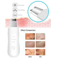 Nettoyeur de peau à ultrasons, éliminateur de points noirs, nettoyeur de pores, appareil de nettoyage en profondeur du visage, appareil de beauté pour le lifting du visage