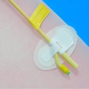 Perlengkapan Medis Jarum Indwelling Perangkat Pengaman Tabung Nasogastrik Sekali Pakai Perangkat Fiksasi Kateter Kustom - Product Image 6