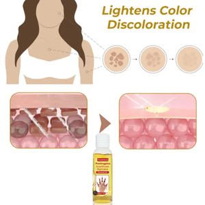 Huile exfoliante à base de plantes jaunes pour les aisselles, les genoux, les mains et les coudes - Éclaircissement et blanchiment du teint de la peau du corps - Product Image 6