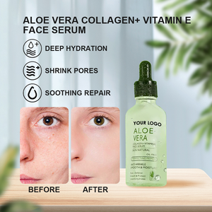 Suero de Aloe Vera para pieles sensibles irritadas, suero facial hidratante calmante, blanqueamiento antiarrugas, reparación calmante OEM/ODM - Product Image 4