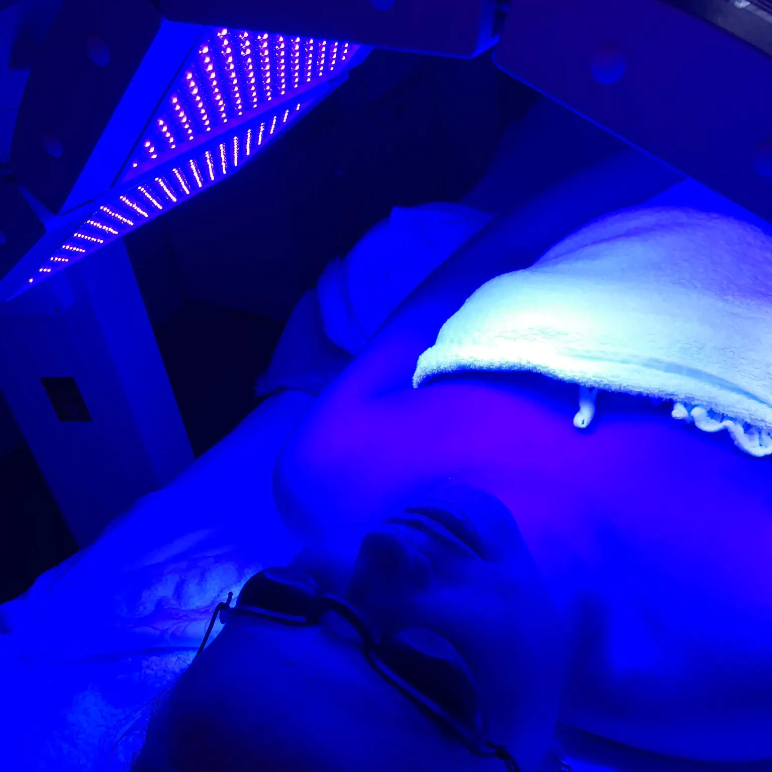 Professionele Fotodynamische Therapie (Pdt) Huidkanker Bccs Ak Behandeling Led Lichttherapie