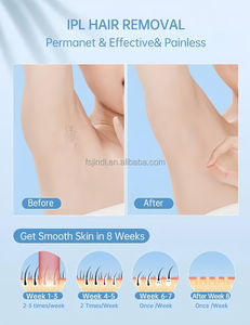 Los más vendidos Dispositivos de depilación ligera con refrigeración por hielo 5 niveles de energía 999999 pulsos de luz Auricular para depilación a largo plazo - Product Image 4