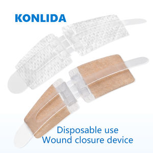 ไหมเย็บแผลแบบซิปสำหรับการดูแลบาดแผลระดับโรงพยาบาล ผลิตภัณฑ์ทางการแพทย์สำหรับคลินิก - Product Image 2
