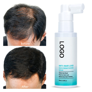 OEM ODM Hair Growth Serum Spray Hair Loss <span class=keywords><strong>Nutrient</strong></span> Solution Organic Biotin Growth Serum Óleo de crescimento de cabelo para homens Mulheres - Product Image 2