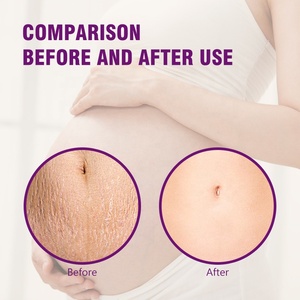 Crème <span class=keywords><strong>anti</strong></span>-vergetures Guanjing, crème réparatrice pour les cicatrices de grossesse, pour les femmes enceintes, pour OEM - Product Image 6