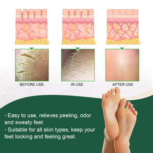 Cuentas de spa para pies rejuvenecedoras, Limpieza Profunda, refrescante, alivia el dolor muscular, cuidado de los pies - Product Image 4