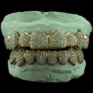 Grillz personnalisés <span class=keywords><strong>en</strong></span> <span class=keywords><strong>argent</strong></span> sterling 925 massif, sertis de moissanite VVS, motif nid d'abeille et zig-zag - Product Image 2