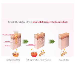 Crema de belleza <span class=keywords><strong>para</strong></span> el cuidado de la piel <span class=keywords><strong>para</strong></span> mujeres, crema de maternidad portátil <span class=keywords><strong>para</strong></span> reparar el embarazo, elimina las marcas de <span class=keywords><strong>cicatrices</strong></span> - Product Image 4