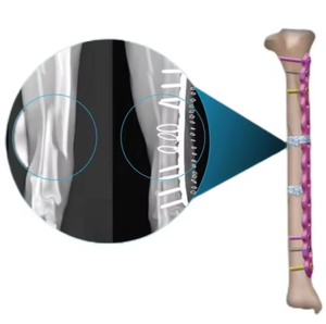 Sistema di piastre di bloccaggio ortopedico veterinario-piastre ossee tagliabili in titanio per artrodesi carpali e tarsali negli animali - Product Image 3