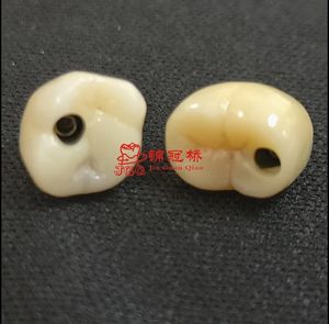 Impianto dentiere il modo migliore per trattare la perdita dei denti. Non danneggiare i denti adiacenti, evitare vicino al carico di forza del morso dei denti - Product Image 6