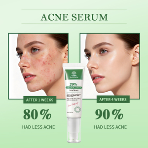 เซรั่มกำจัดสิวสูตรคอลลอยด์ซัลเฟอร์ 20% ระดับมืออาชีพ สำหรับรักษาสิว รอยดำ รอยแดง <span class=keywords><strong>สิว</strong></span>หัวขาว <span class=keywords><strong>สิว</strong></span>หัวดำ <span class=keywords><strong>ผลิตภัณฑ์</strong></span>ดูแลผิว OEM - Product Image 5
