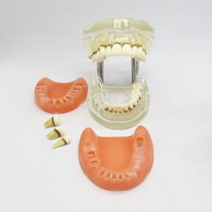 Parodontitis Model Medische Wetenschap Tandheelkundig Model Voor Opleiding In Scholen En Ziekenhuizen - Product Image 2
