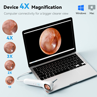 Ensemble d'otoscopes visuels intelligents Q12, prise en charge de l'observation en temps réel sur PC, jusqu'à 128 Go, caméra d'oreille numérique portable, photos et vidéos HD, otoscope