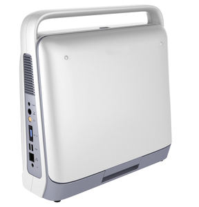 Pemindai <span class=keywords><strong>Ultrasound</strong></span> Portabel Dokter Hewan Peralatan <span class=keywords><strong>Ultrasound</strong></span> Kuda Hewan <span class=keywords><strong>Laptop</strong></span> <span class=keywords><strong>Ultrasound</strong></span> Doppler Warna untuk Dokter Hewan - Product Image 2