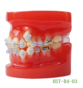 Modello dentale con anello di legatura del filo dell'arco Ortho staffa in ceramica modello di protesi modello di pratica <span class=keywords><strong>standard</strong></span> - Product Image 2