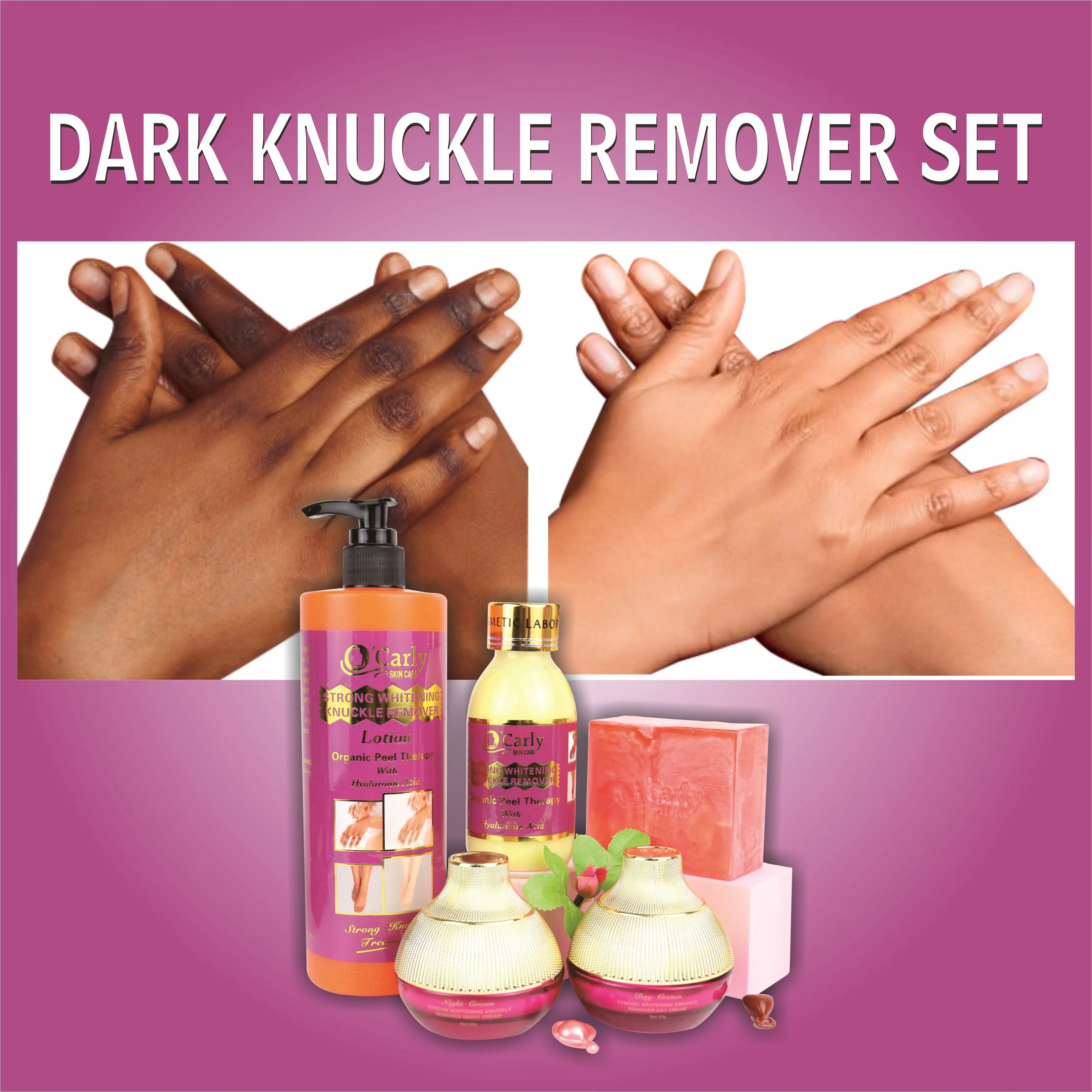 Personalizza la cura della pelle Knuckle Acne-Aid Whitening Set piante crema per il viso acido ialuronico Kojic Oil Serum nuovi Set di rimozione delle macchie scure