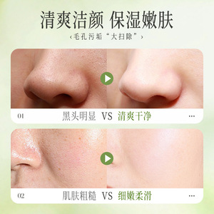 Mascarilla Facial de Burbujas con Ácido de Aguacate Nalan Doctor Compound Acid, 4g*12 Tiras, Limpiadora, Exfoliante e Hidratante - Product Image 3