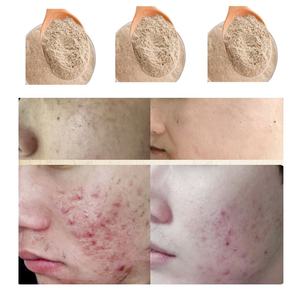 Maschera Purificante in Polvere S Brown Alage con Spicule Vegetali per Cosmetici e Forniture per Estetiste - Ingrosso - Product Image 5