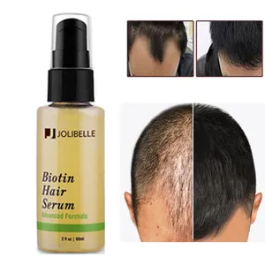 OEM Private Label Biotin Hair Growth Serum Oil Natural Prevent Hair Loss Help Grow Healthy Strong Organic Hair Care Oil