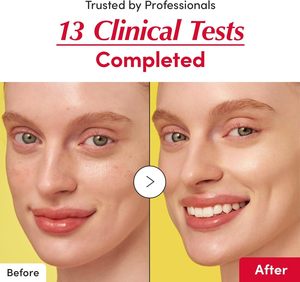 Sérum à la vitamine C pour le visage, essence hydratante illuminante, soin de la peau, réparation, sérum à la niacinamide, éclaircissant, sérum à l'acide hyaluronique - Product Image 3