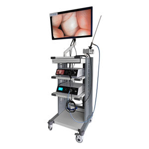 Sistema de Cámara de Endoscopio Endoscópica Médica 4K HD <span class=keywords><strong>TUYOU</strong></span> Fabricante 2025 con Torre de Monitor para Cirugía, Otorrinolaringología, Laparoscopia y Urología - Product Image 3