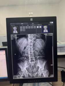 Monitor Táctil Médico Todo en Uno de 20.1 Pulgadas, Panel PC Interactivo, de Escritorio o Montaje en Pared, para Veterinaria - Product Image 5