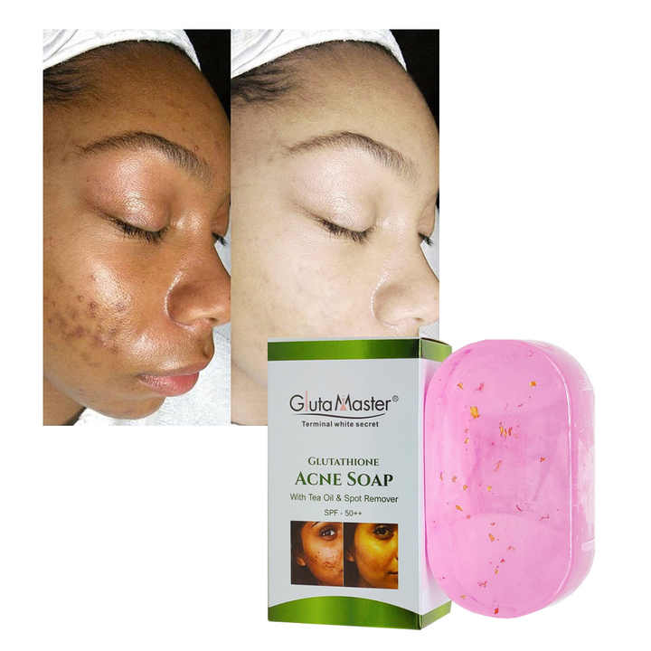 glutathione soap before and after Gluta Master Whitening with Tea Oil & SPF 50++ Ashwagandha - What Should تونر booster كوري Size:Two Packs of 50