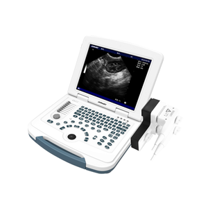 Escáner de Ultrasonido Veterinario Portátil en Blanco y Negro Económico para Diagnóstico de Gestación - Product Image 3