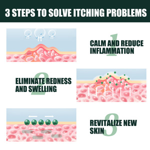 ครีมรักษาโรคสะเก็ดเงินแก้คันผิวหนังโรคสะเก็ดเงินครีมบำรุงผิวเท้ามอสที่เท้าครีมสำหรับการรักษาเชื้อราภายนอก - Product Image 5