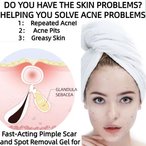 Bifidobacterium lên men lysate điều trị mụn trứng cá Gel kiểm soát dầu mụn giảm tất cả các loại da không có động vật chống mụn Gel - Product Image 5