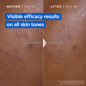 Crème au beurre de karité <span class=keywords><strong>Mixa</strong></span> Niacinamide Vitamine C Ultra Douce à l'Urée et au Cica Réparatrice 400ml - Product Image 3