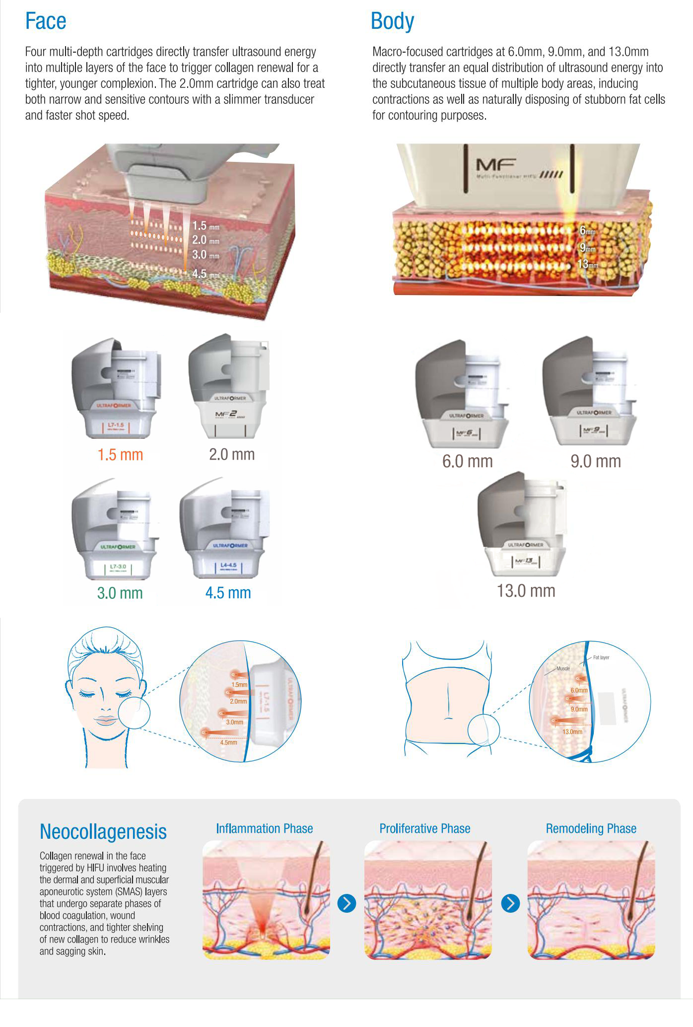 2023 New Arrival 5 in 1 7D HIFI Ultra sound Skin Tightening Eye Lift Face Lifting Neck Tightening Body Slimming Machine