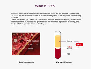 PRP 튜브 세트 의료 용품 12ml PRP 플라즈마 교체 컬렉션 튜브 판매 - Product Image 6
