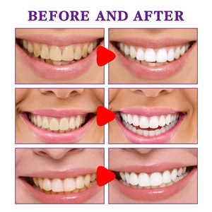 Pasta Dental Blanqueadora Jaysuing, Elimina las Manchas Amarillas de los Dientes, Cuidado Bucal, Mal Aliento, Pasta Dental Blanqueadora - Product Image 5