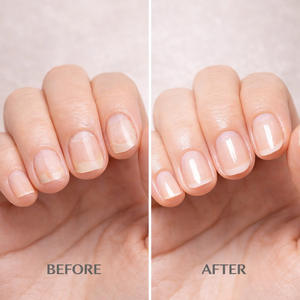 Huile de soin des ongles de qualité supérieure - Nourrissant quotidien doux, nourrit les ongles des mains et des pieds pour une brillance éclatante - Product Image 5