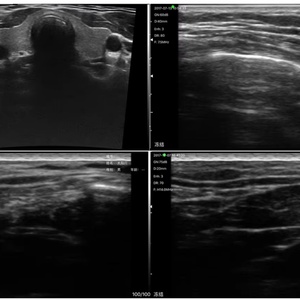 Échographe linéaire sans fil de haute qualité pour cliniques vétérinaires et cliniques, scanner portable pour le dépistage du cancer du sein et l'échographie vasculaire BW12 - Product Image 6