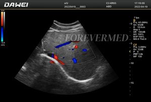 Ecógrafo Portátil Doppler Color 4D 5D, Máquina de Ultrasonido Digital Completa - Product Image 6