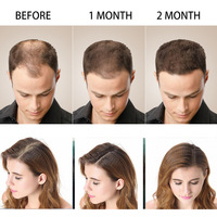 Shampoo anti-chute de cheveux Disaar Organisateur Hommes et femmes Shampooing naturel à la croissance du gingembre pour cheveux abîmés