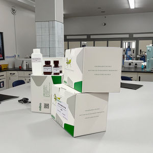 सीरम कुल लोहे-बाइंडिंग क्षमता (टीबीसी) परख किट - Product Image 4