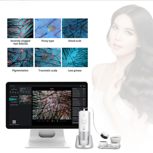 Analizador de Cabello Inteligente con IA de Alta Calidad, Detección Facial, Almacenamiento en la Nube, Pantalla de 15.6 Pulgadas, 13 Indicadores de Detección, UE - Product Image 2