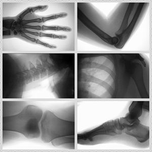 Petite machine de rayon X/radiographie portative de fluoroscopie avec le grand écran - Product Image 6