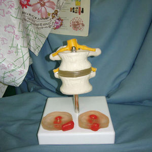 Modèle anatomique de la colonne vertébrale humaine avec deux disques intervertébraux lombaires et deux lésions Matériau en PVC Structure anatomique vive - Product Image 5